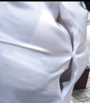 Tràn viền