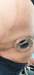 soi anal