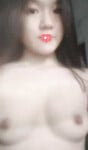Vú của em Thùy qua từng ngày