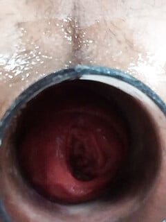 anal soi